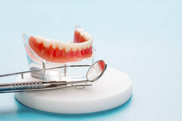 Dental Bonding in Lexington, TX